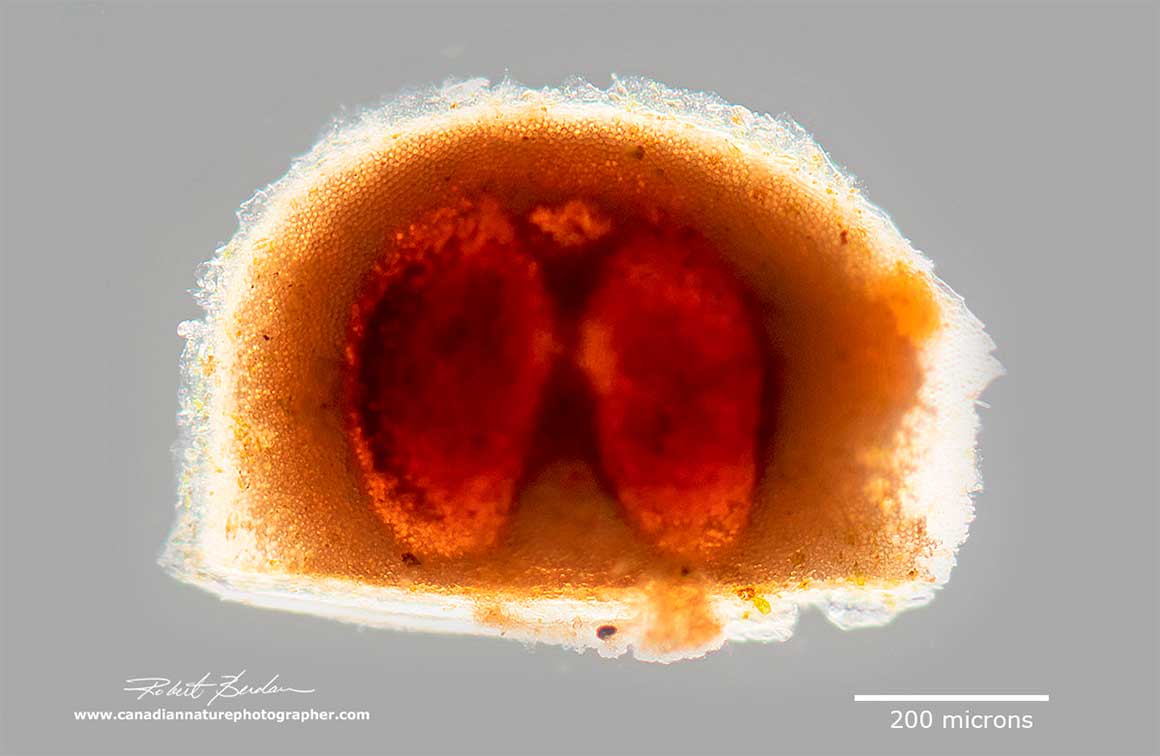 ephippium containing two eggs from a Daphnia sp by Robert Berdan ©
