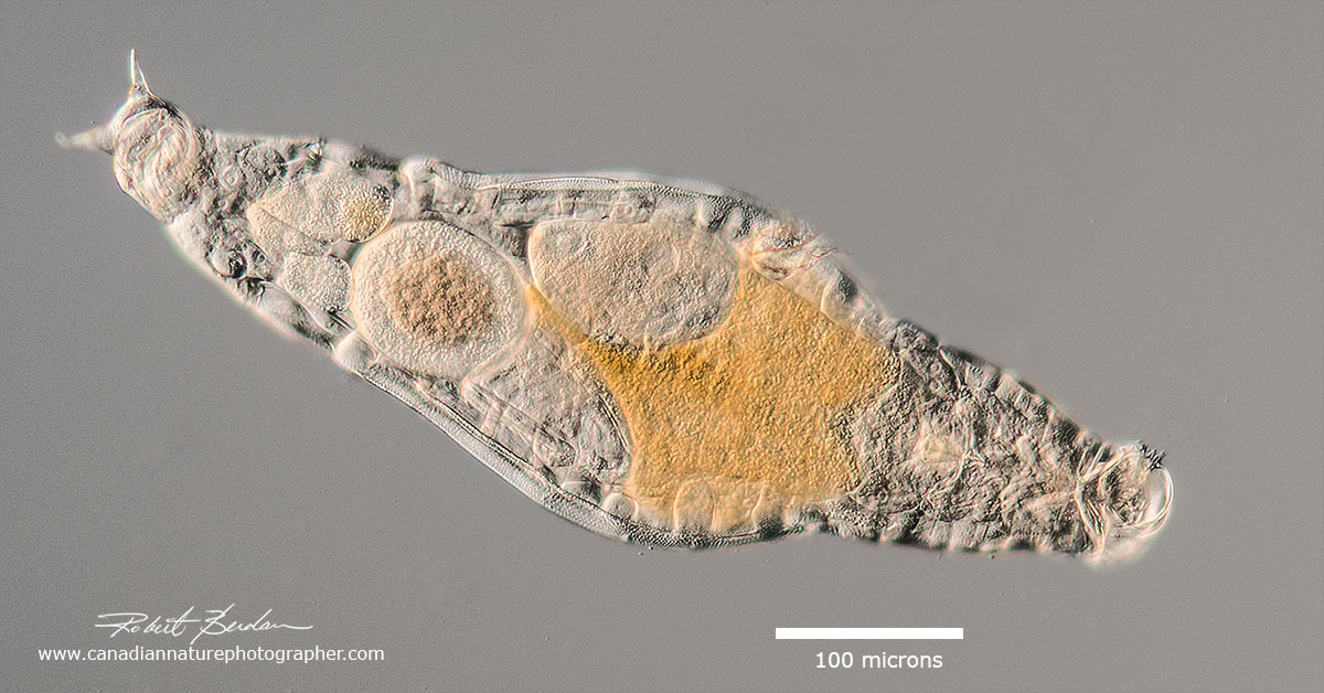 Large Bdelloid rotifer found in moss by Robert Berdan ©