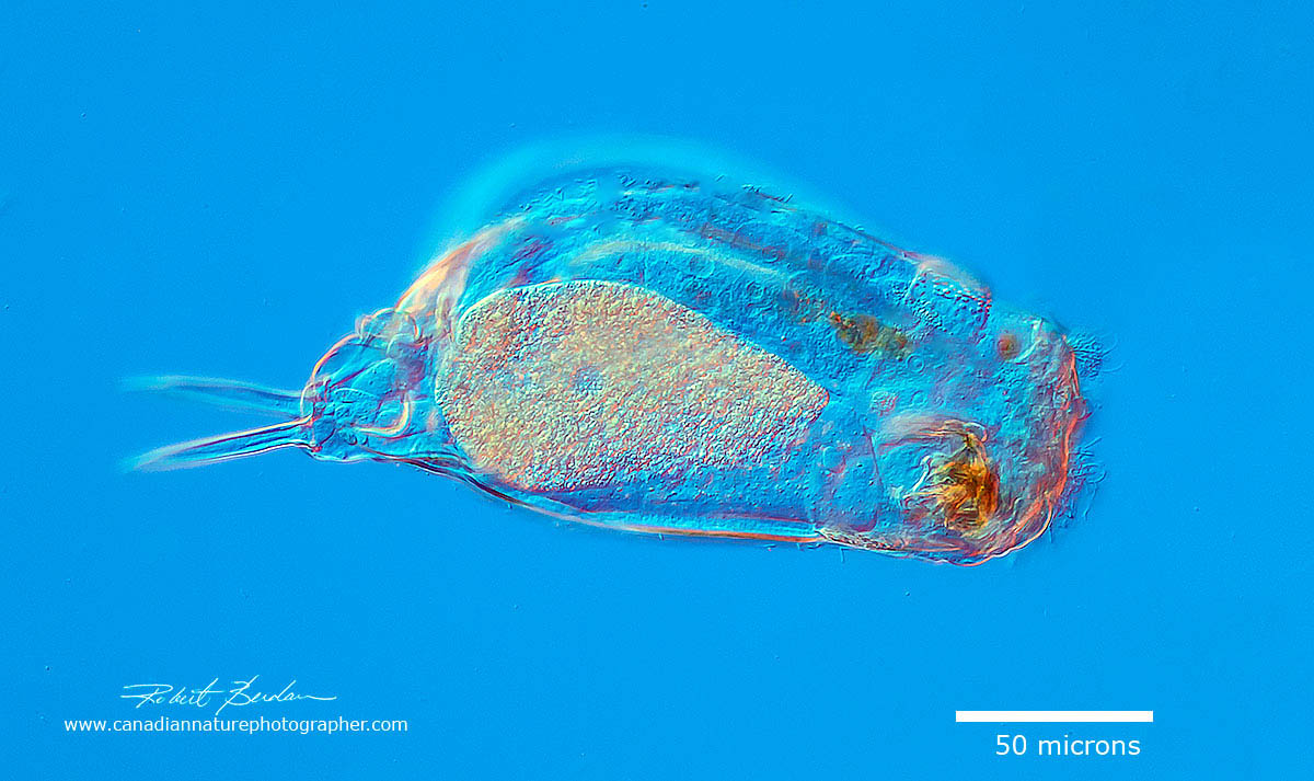 Euchlanis dilatata - a rotifer common in pond water by Robert Berdan ©