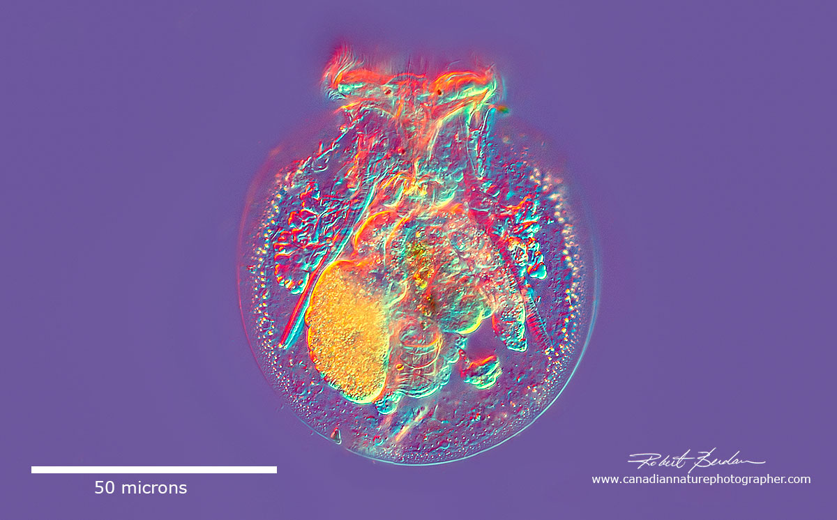 Testudinella patina - Turtle Rotifer DIC microscopy by Robert Berdan 