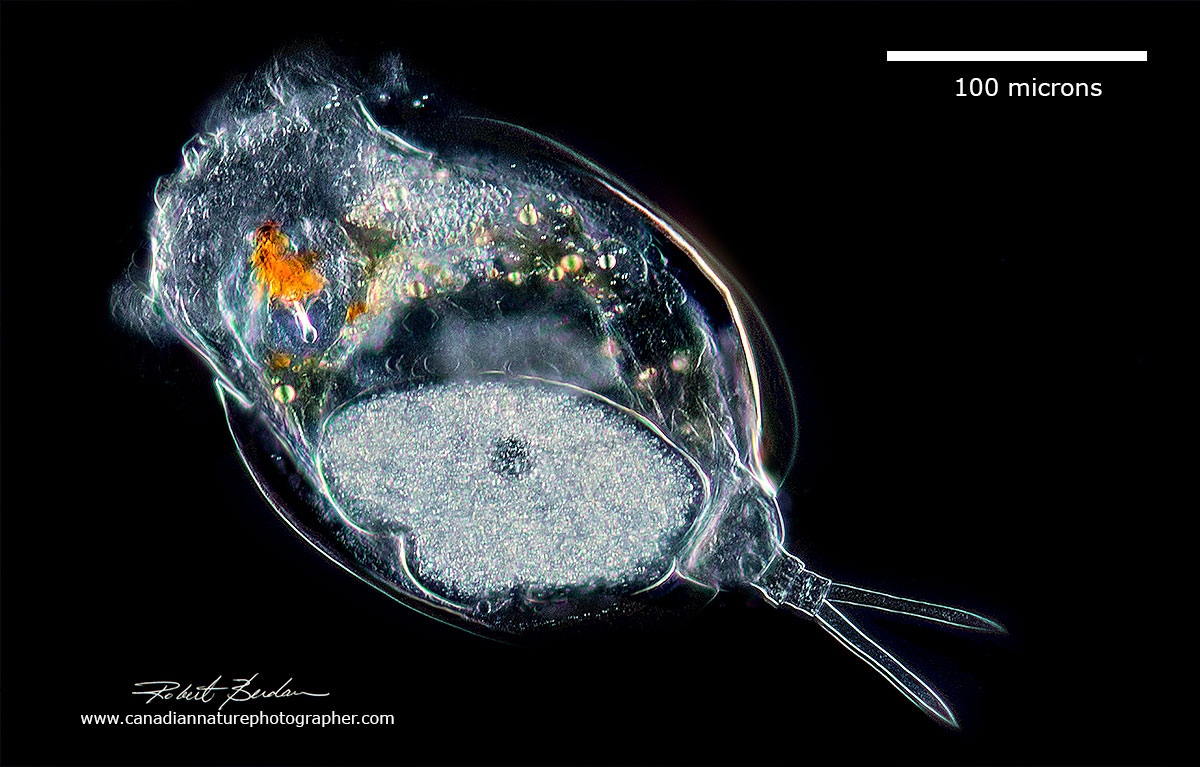 Euchlanis sp viewed by Dark field microscopy by Robert Berdan ©