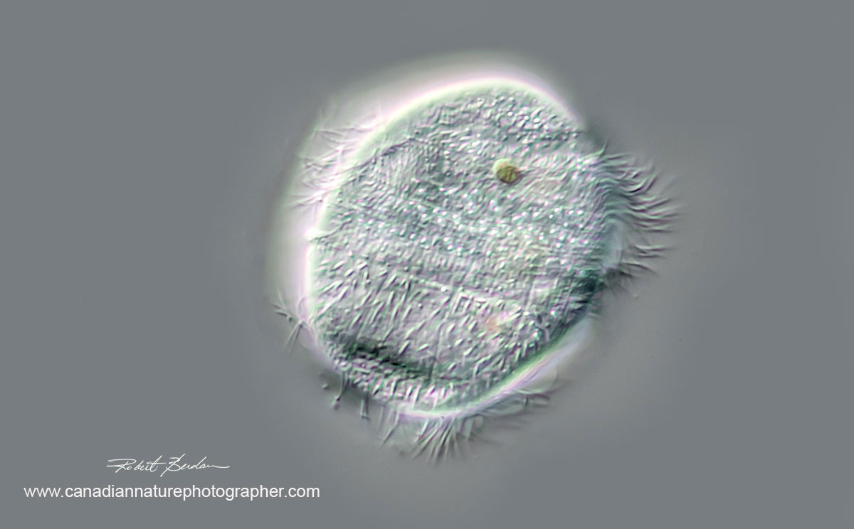 Ciliate, Family Parameciidae possibly Uroncentrum turbo 400X DIC microscopy by Robert Berdan ©