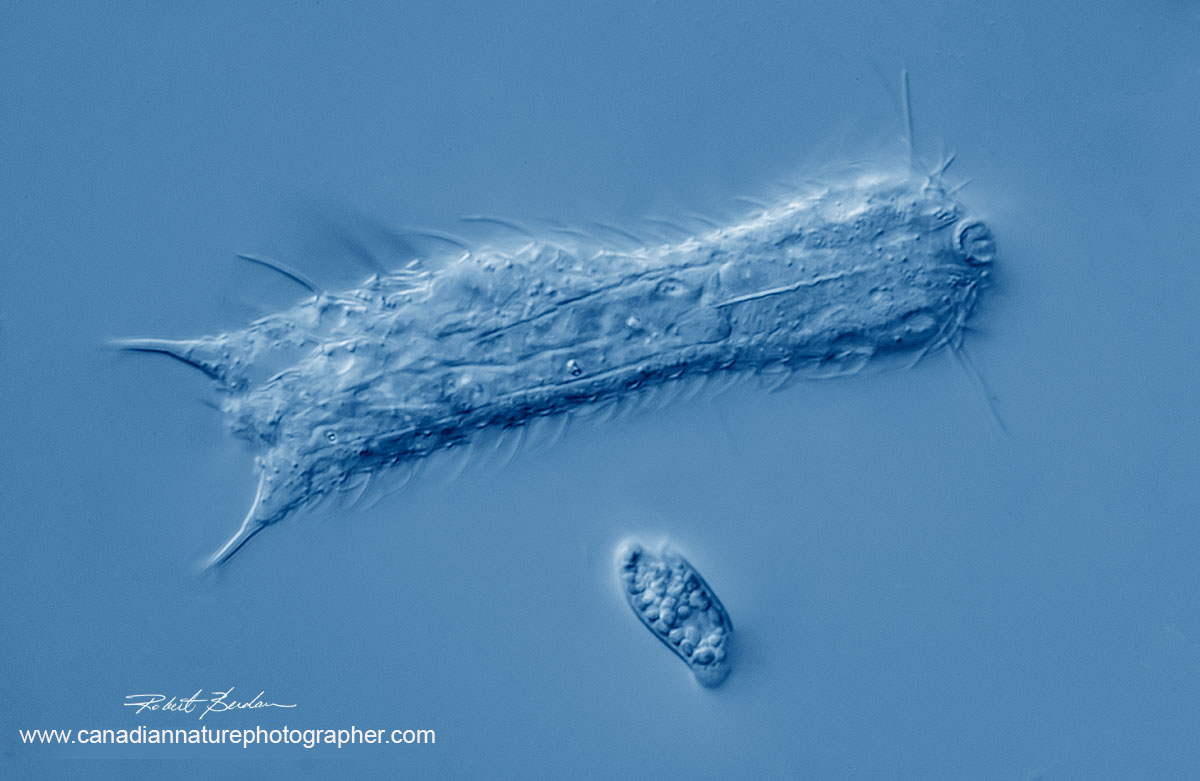 Chaetonotus similis 400 X DIC microscopy by Robert Berdan ©