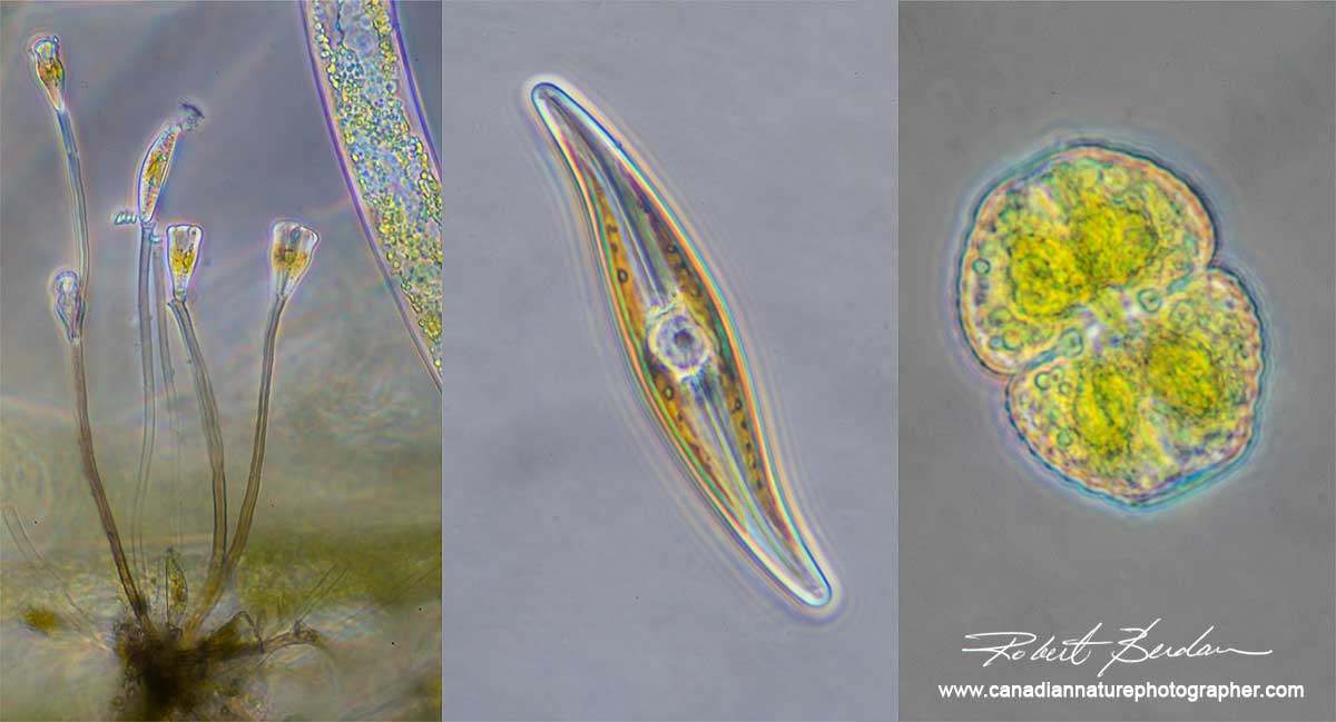 Diatoms and Desmid by Robert Berdan ©