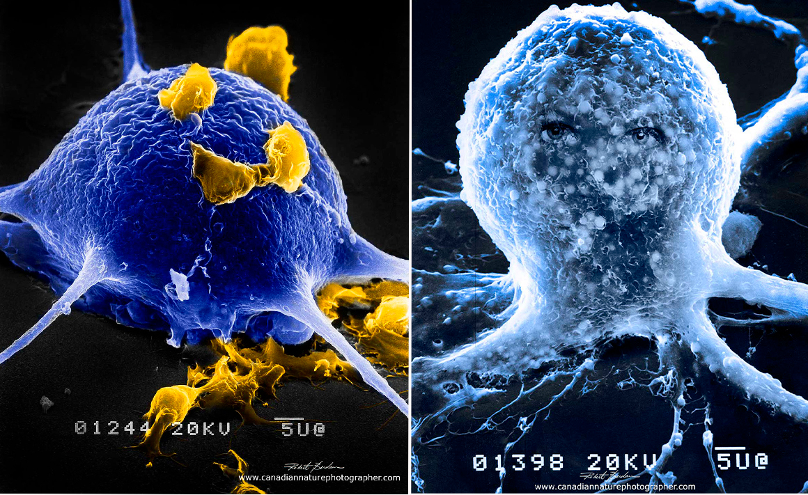 scanning electron micrographs of isolated brain cells from Helisoma trivolvis grown in culture by Robert Berdan ©