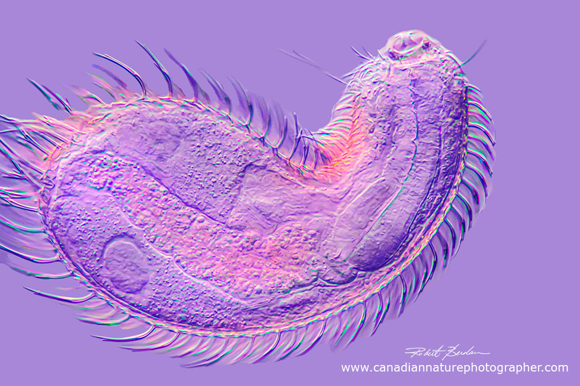 gastrotrich taken at 630X with DIC microscopy by Robert Berdan ©