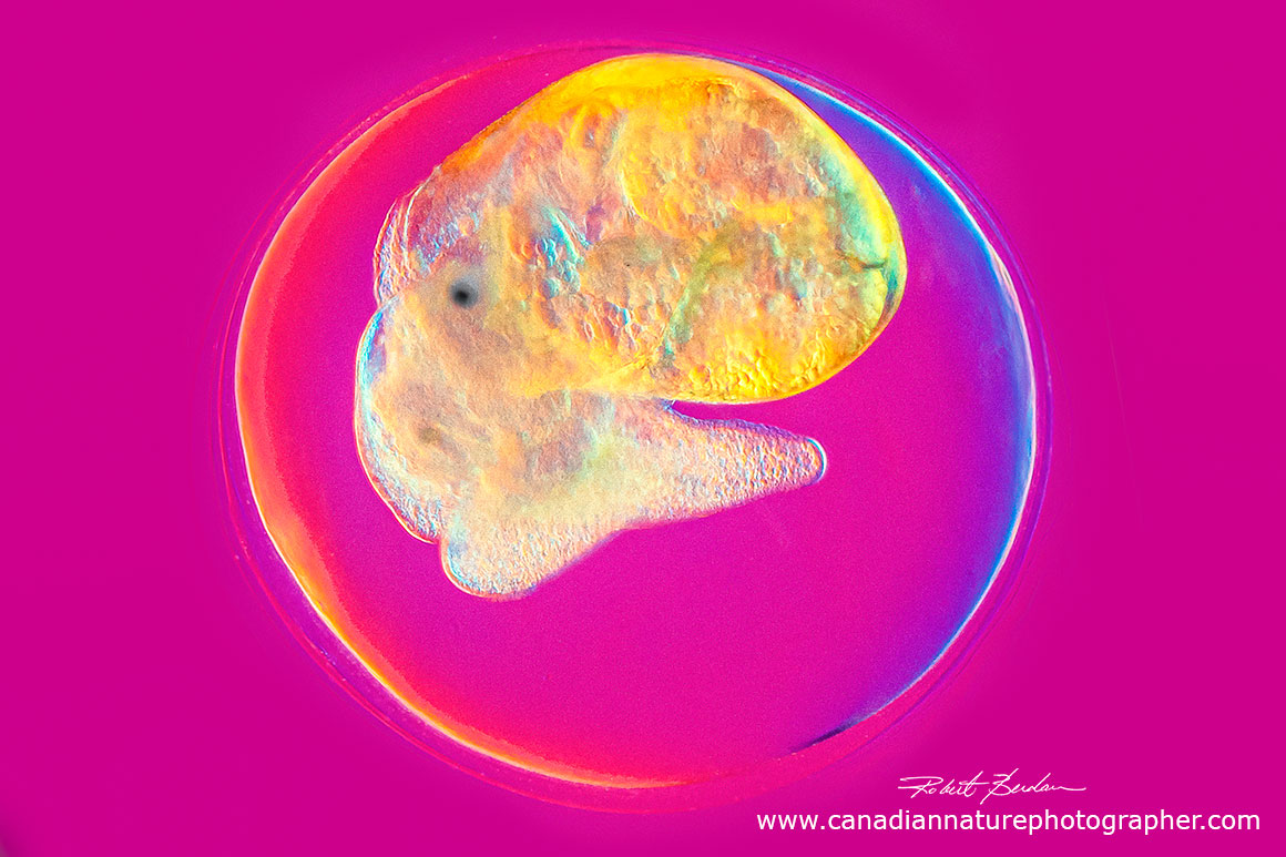Fresh water snail (Helisoma trivolvis) embryo still in its egg 200X DIC microscopy by Robert Berdan 