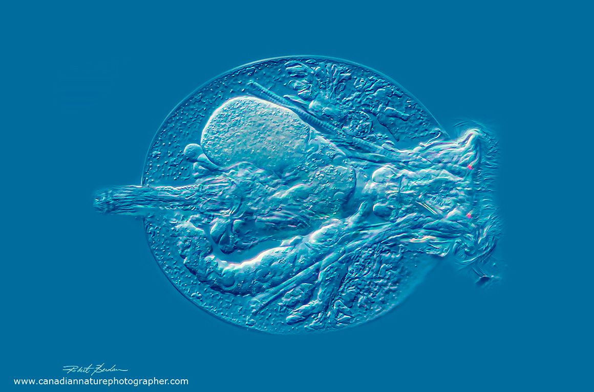 Testudinella patina is also called a turtle rotifer by Robert Berdan ©