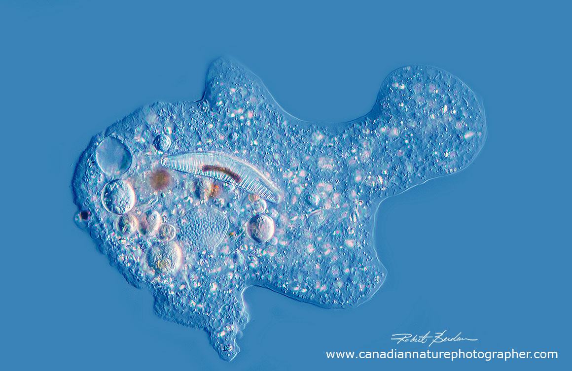 Amoeba proteus  by DIC microscopy by Robert Berdam ©