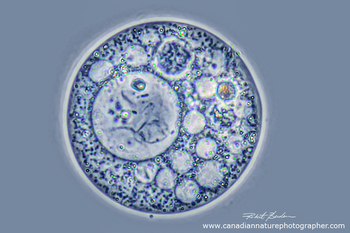 amoeba from pond water and taken at 1000X using phase contrast microscopy by Robert Berdan ©