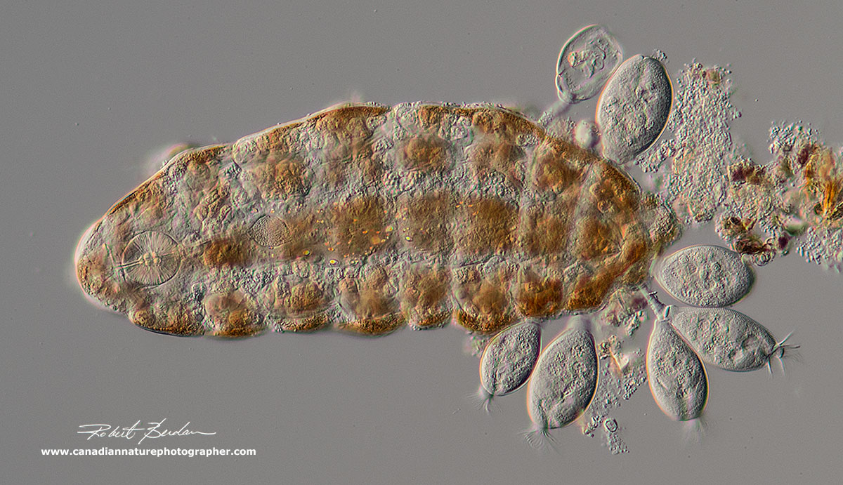 tardigrade with attached ciliates, photographed at 200X using differential interference contrast (DIC) microscopy. The tardigrade is Ramazzottius oberhaeuseri, and the ciliates clustered near its posterior end appear to be Pyxidium tardigradum. by Robert C. Berdan