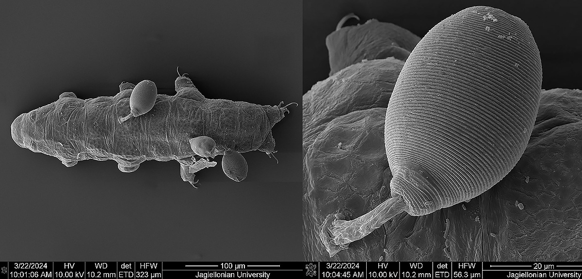 Above is a tardigrade with attached ciliates, photographed at 200X using differential interference contrast by Robert C Berdan