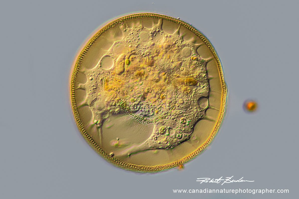 Live Arcella sp. is a shelled amoeba by DIC microscopy Robert C. Berdan 