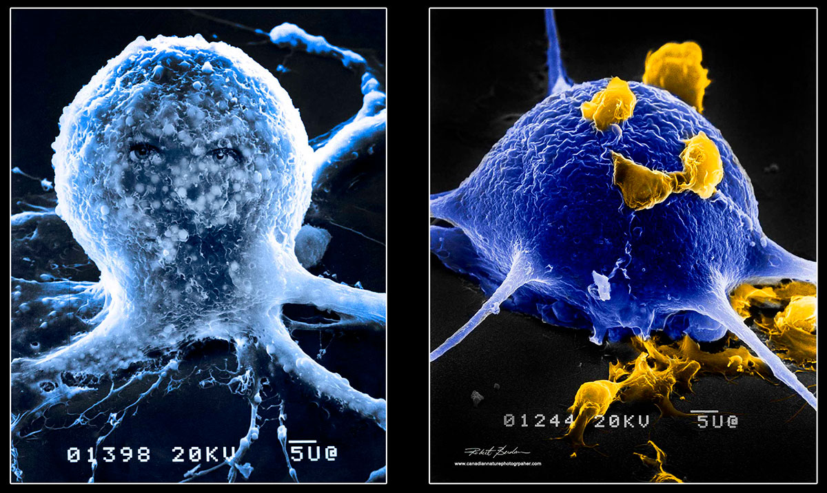 Isolated neurons from a freshwater snail neurons grown in culture and examined by scanning electron microscopy by Robert C Berdan