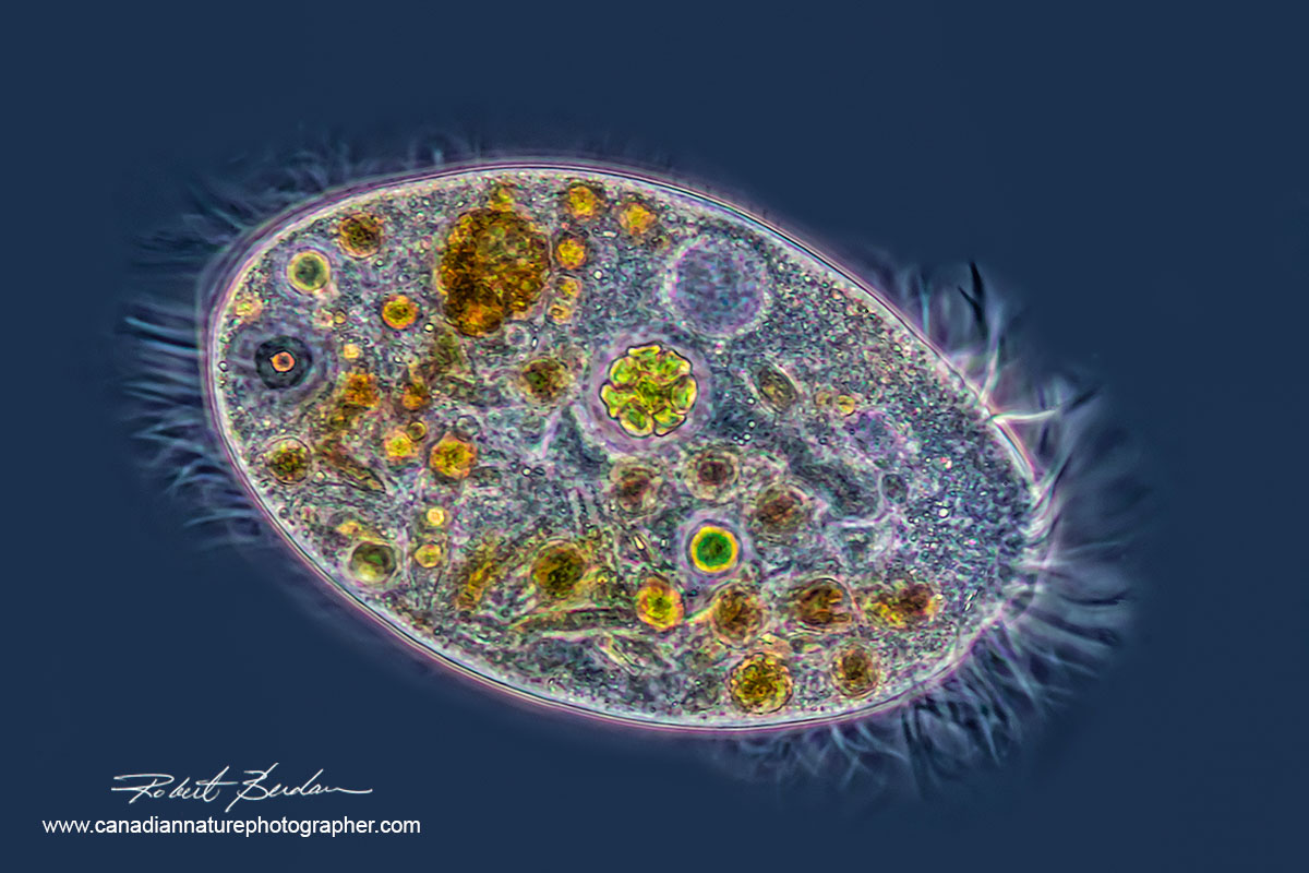 Ciliate by phase contrast microscopy by Robert Berdan ©