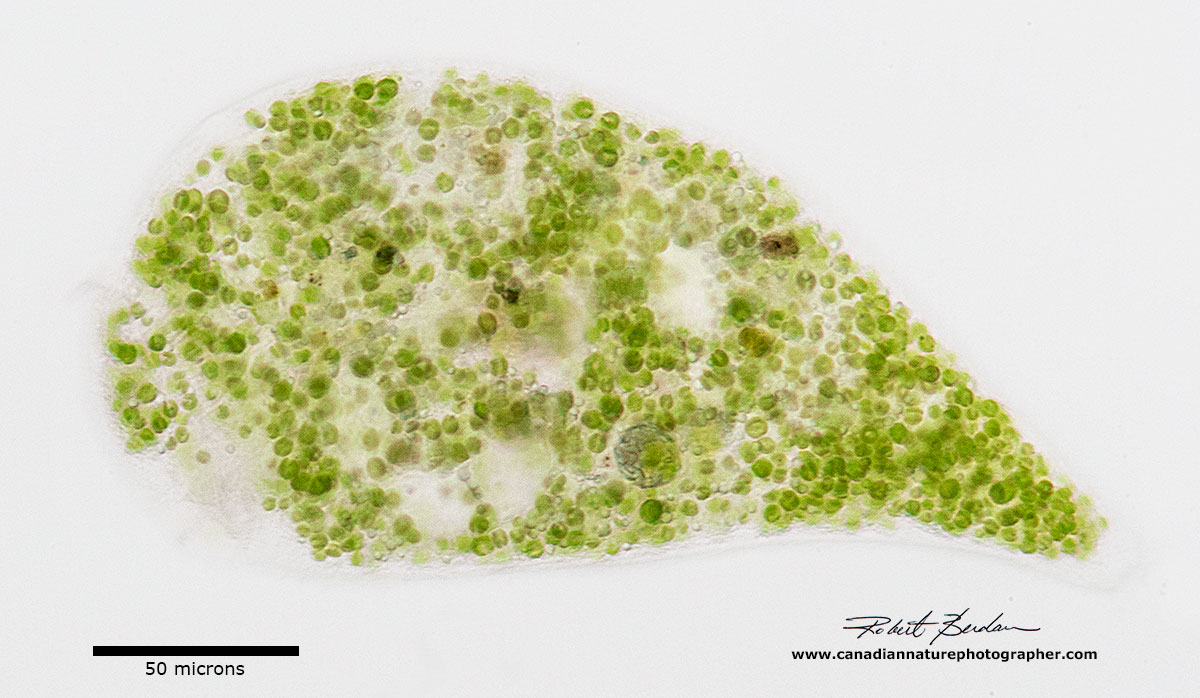 Stentor polymorphus bright field microscopy by Robert Berdan ©