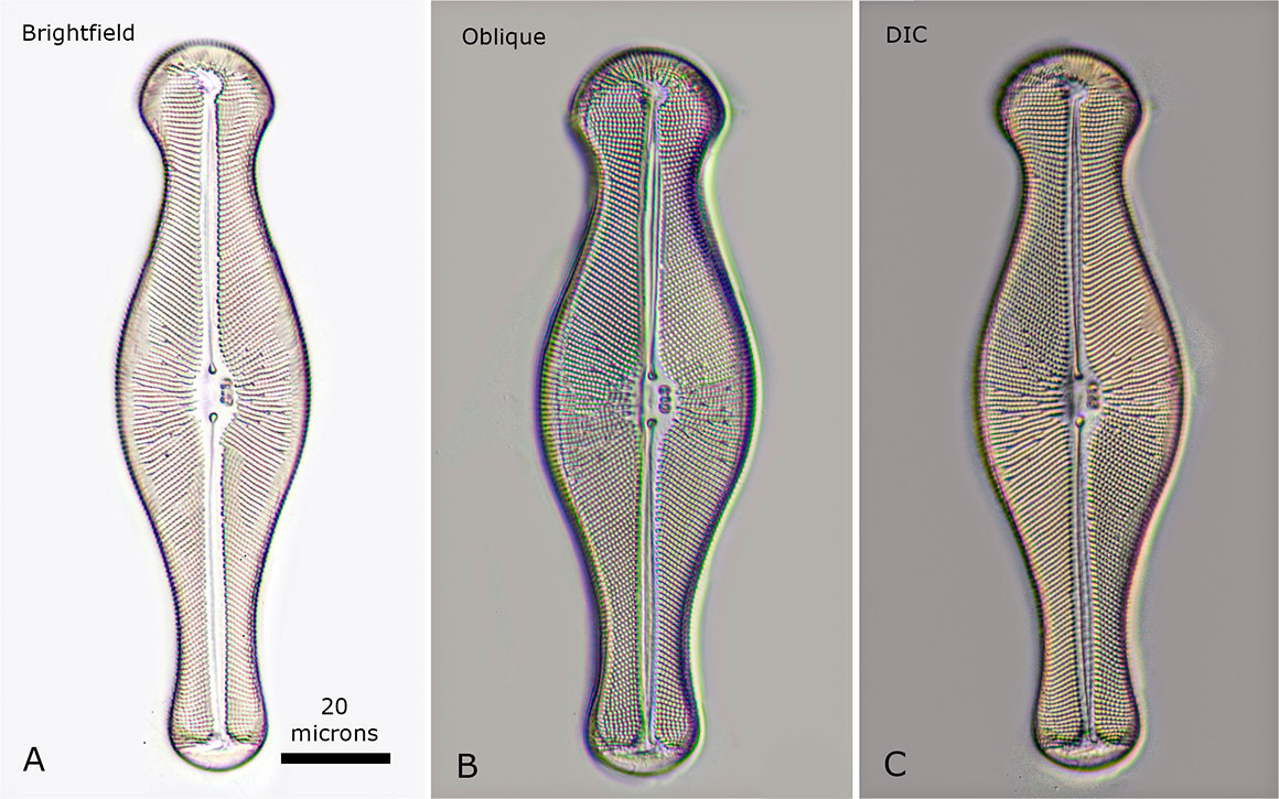 Diatom Gomphonema sp viewed with three different microscopy techniques. A) bright-field B) oblique lighting and C) DIC microscopy. by Robert Berdan ©