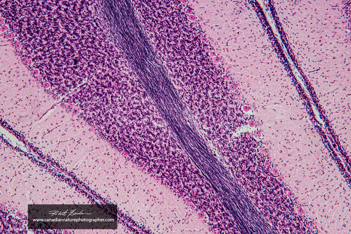 Cerebellum Nikon D800 100X Brightfield microscopy by Robert Berdan ©