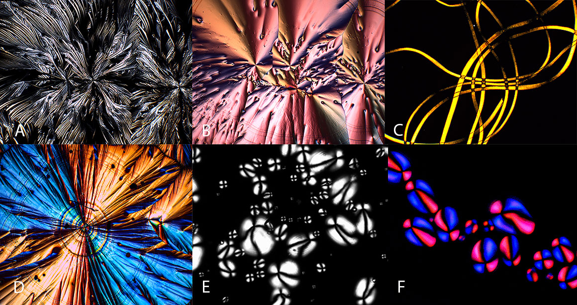 Montage of images taken with the Motic Camera a) Vitamin C crystals polarized light 100X B) Vitamin C crytals polarized light 100X C) Wool fibers polarized light 100X D) Vitamin C crystals polarized light 100X E) Potato starch grains polarized light 100X F) Potato starch grains 100X  Robert Berdan ©