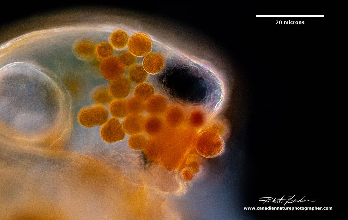 Vorticella on the head of a Daphnia stained with Lugol's iodine - Darkfield microscopy by Robert Berdan ©