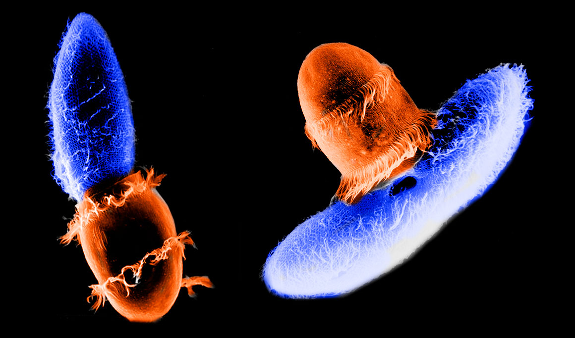 Coloured scanning electron micrographs of Didnium (orange) feeding on Paramecium (blue) photo by Gregory Antipa