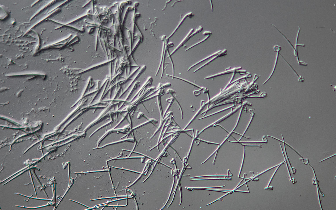 Trichocysts from Paramecium DIC microscopy by Robert Berdan ©