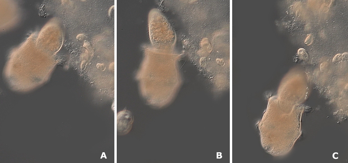 Three frames from a video after Didinium captured a Paramecium. DIC microscopy by Robert Berdan ©
