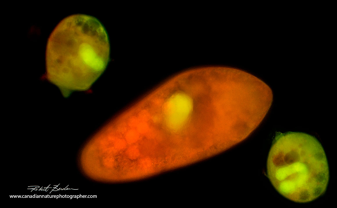 Several Didinium nasutum surrounding a Paramecium caduatum after staining with Acridine orange Fluorescence microscopy 100X Robert Berdan ©