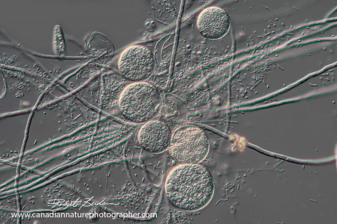 Didinium nasutum by DIC microscopy Robert Berdan ©