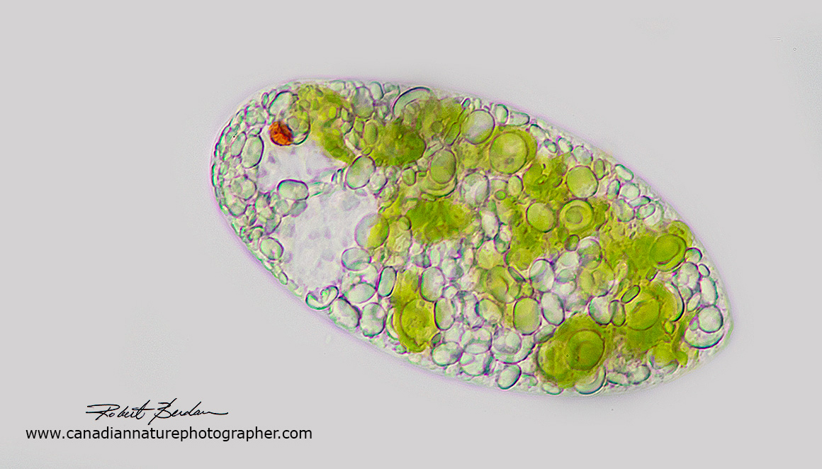 Euglenoid species by bright field microscopy by Robert Berdan ©