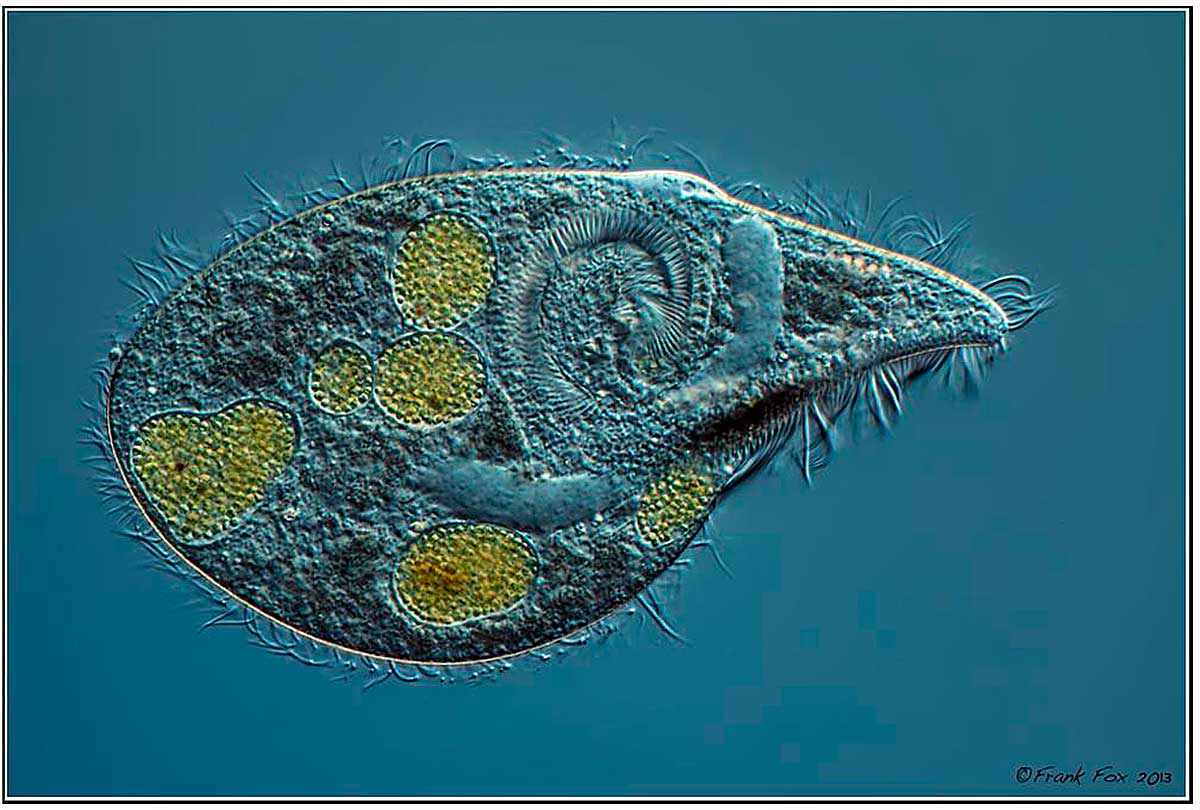 Ciliated Protozoan by Frank Fox ©