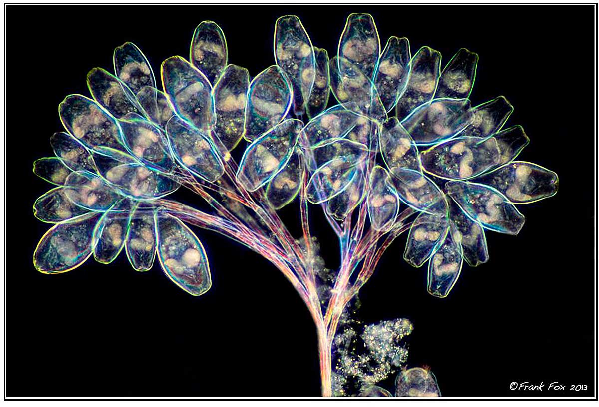 Vorticella - a protozoan, Approx. 400X Darkfield Microscopy by Frank Fox ©