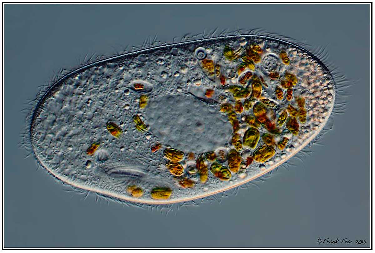 Ciliated protozoan by Frank Fox Differential Interference contrast microscopy ©