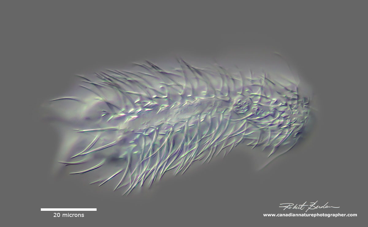 Chaetonotida sp - I focused on the dorsal surface to show the porcupine-like spines by Robert Berdan ©