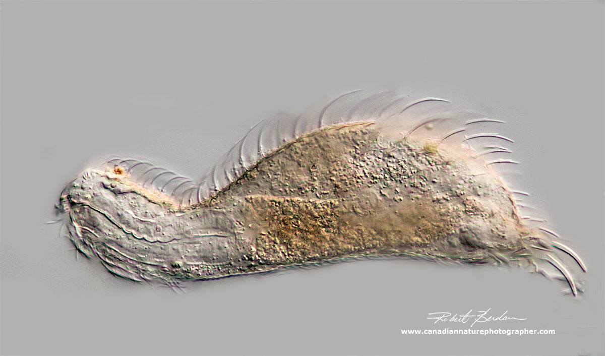 Chaetonotus sp. side view of the animal DIC microscopy  by Robert Berdan ©