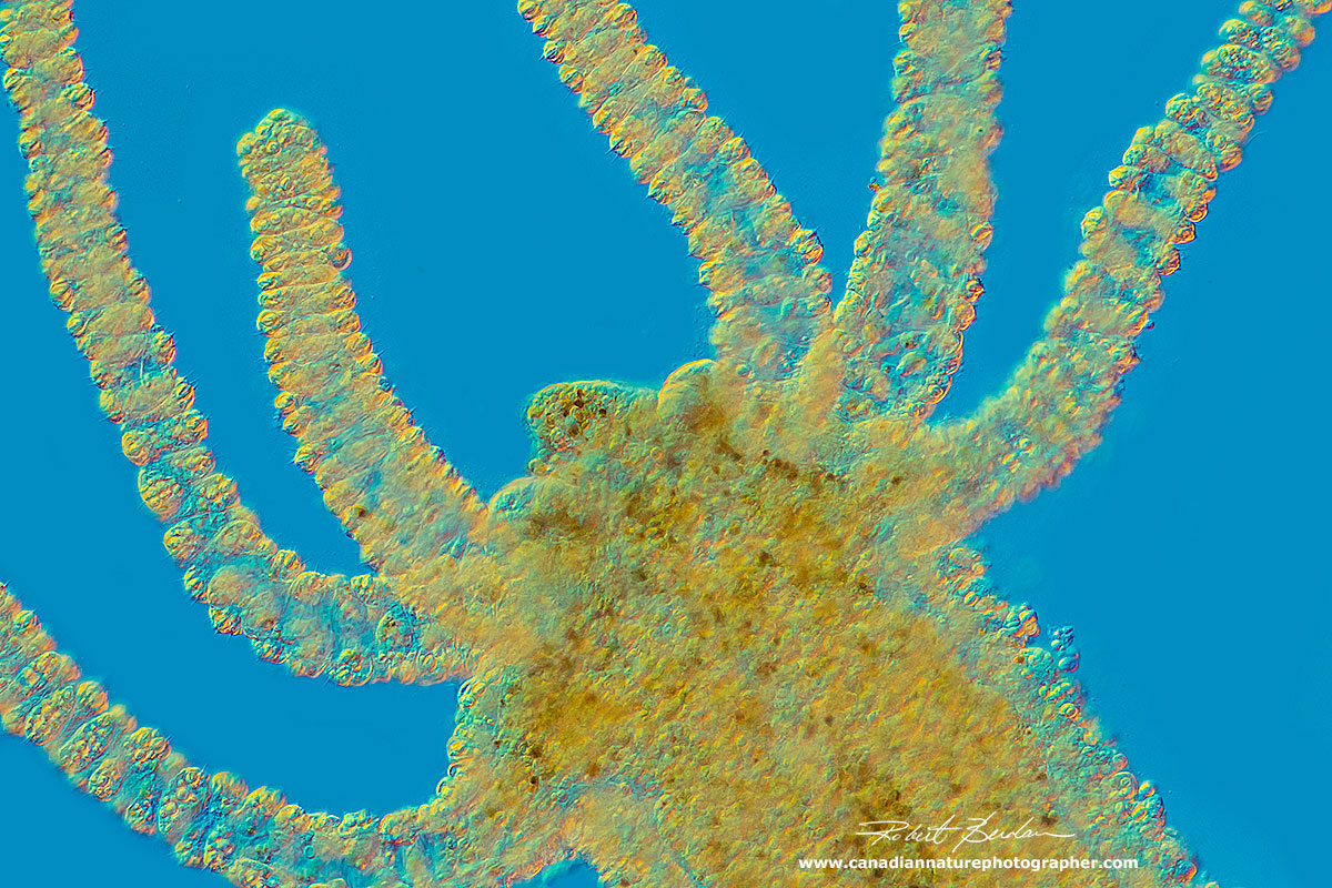 Hydra hydranth - the mouth opens at the apical end. DIC microscopy by Robert Berdan ©