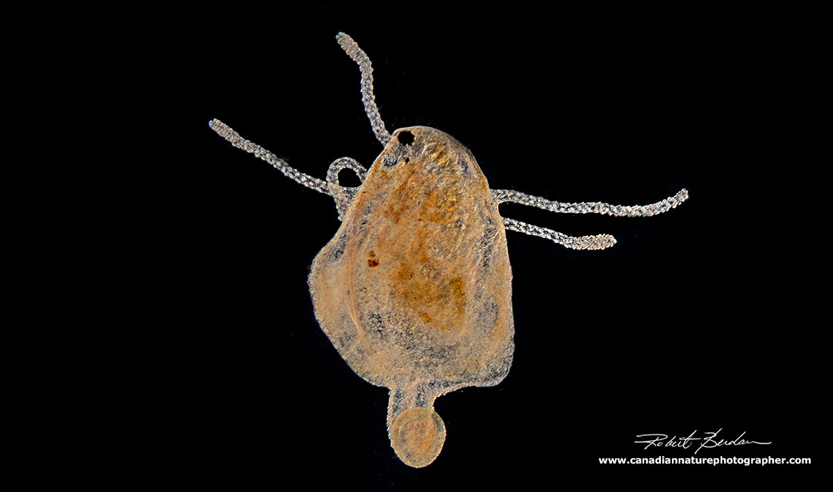 Hydra feeding on Daphnia DIC and Darkfield microsopy by Robert Berdan 