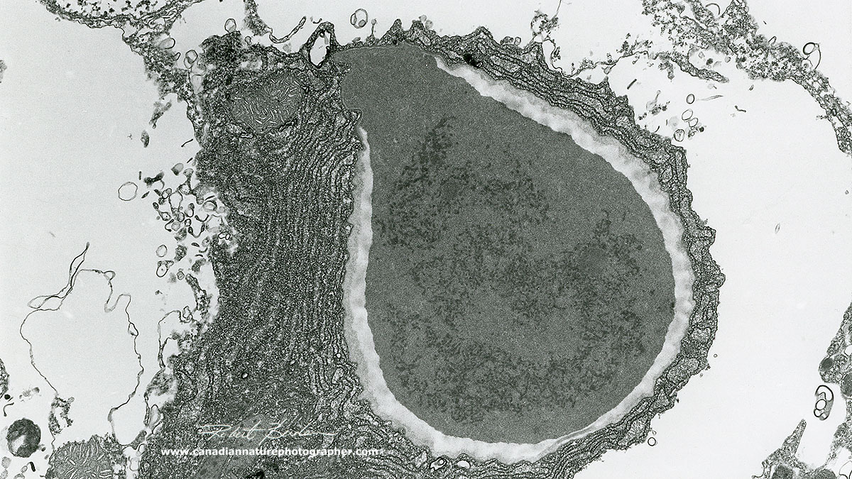Electron micrograph of a developing cnidoblast - R. Berdan ©