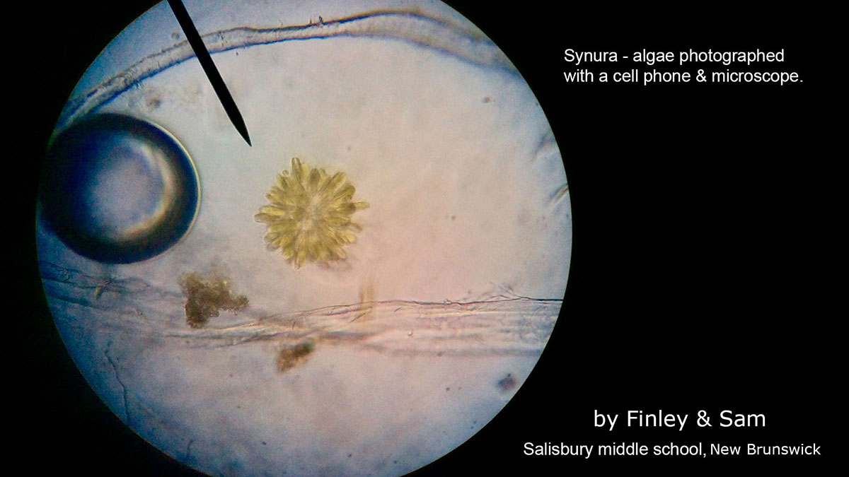 Synurid photomicrography taken with a cell phone camera 