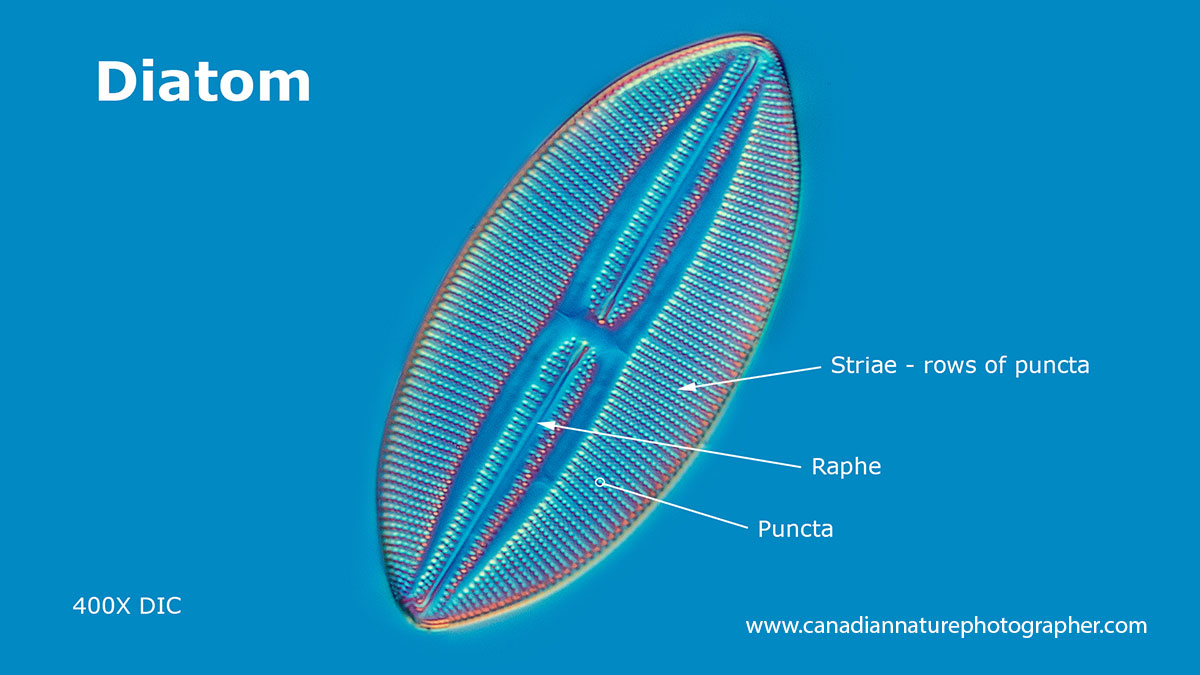 Diatoms Under Microscope 400x