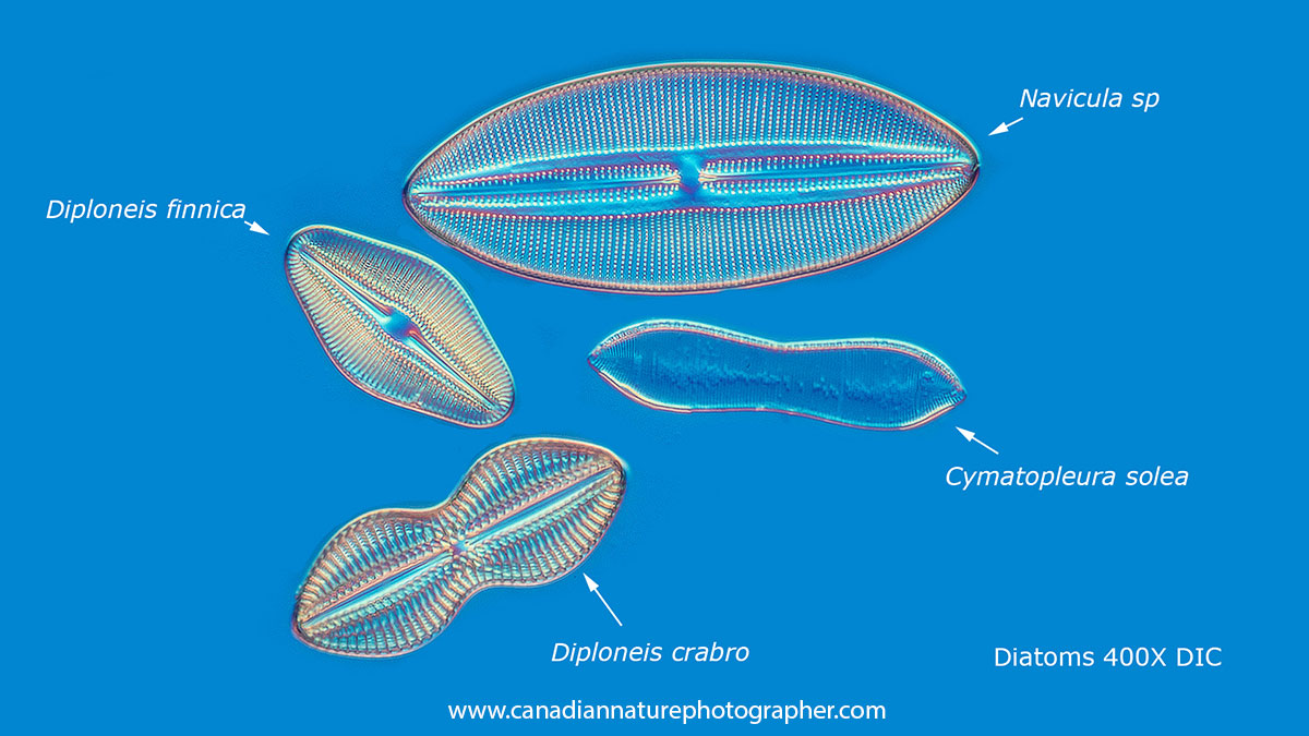 Several Diatoms by DIC microscopy by Robert Berdan ©