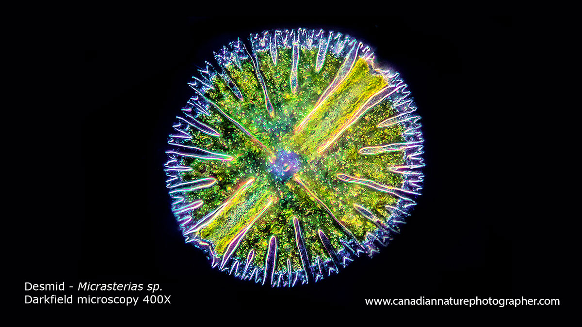 desmid Micrasterias Darkfield microscopy Robert Berdan ©