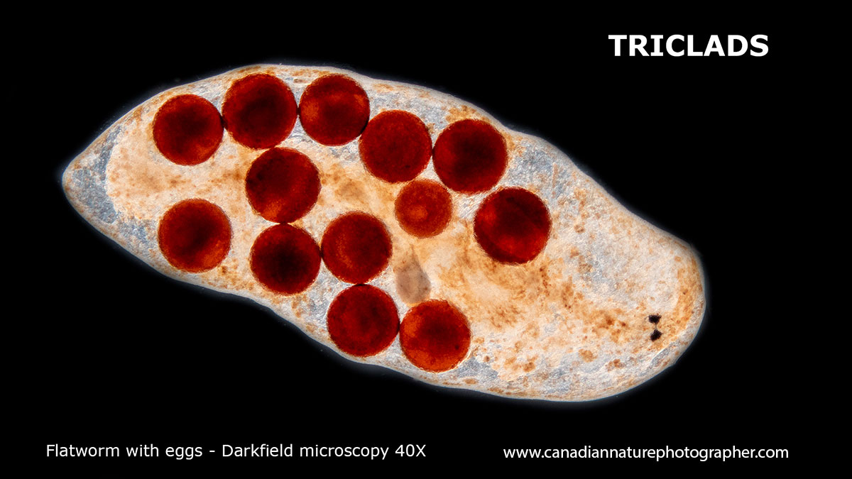 Triclad with 2 eyes and several eggs inside its body. Darkfield microscopy 40X Robert Berdan ©
