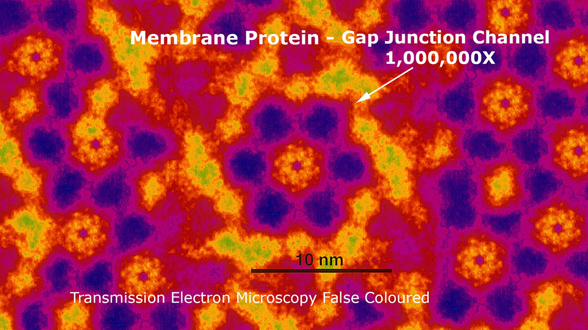 Gap junction protein magnified 1,000,000X by transmission electron microscopy Robert Berdan ©