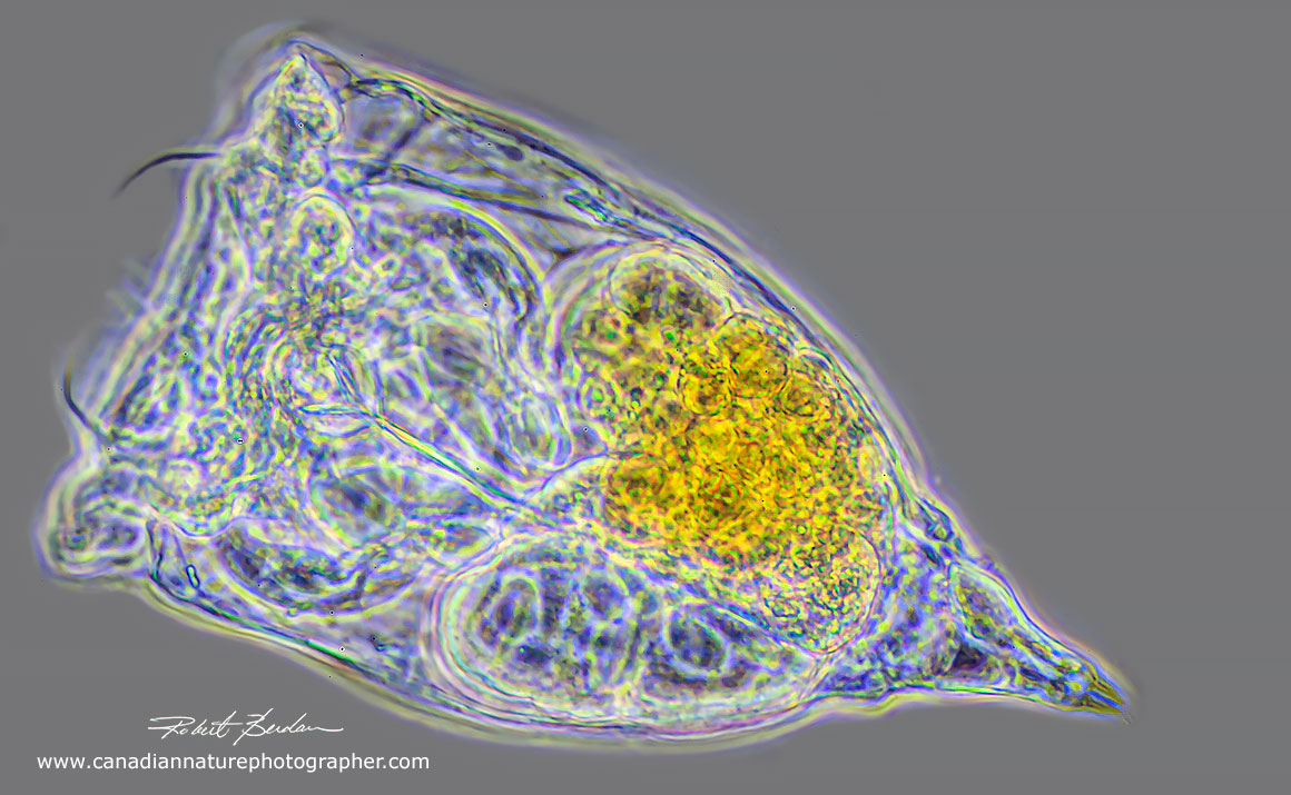 Syncheata sp of Rotifer by phase contrast microscopy 400X by Robert Berdan ©