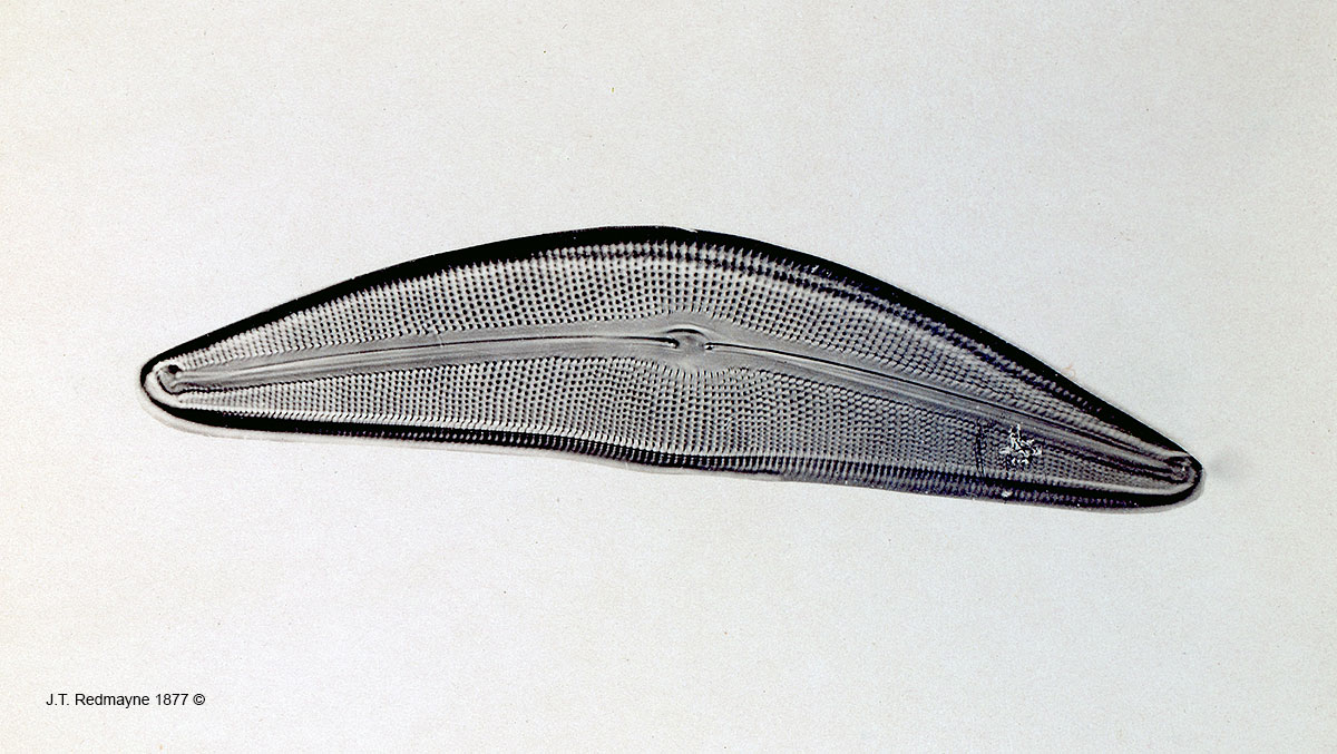 Diatom Cymbella gastroides Plate 31 Magnification 500X  by J.T. Redmayne 1877