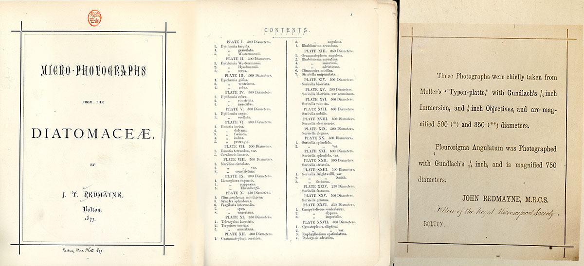 Diatomacae by J.T. Redmayne 1877
