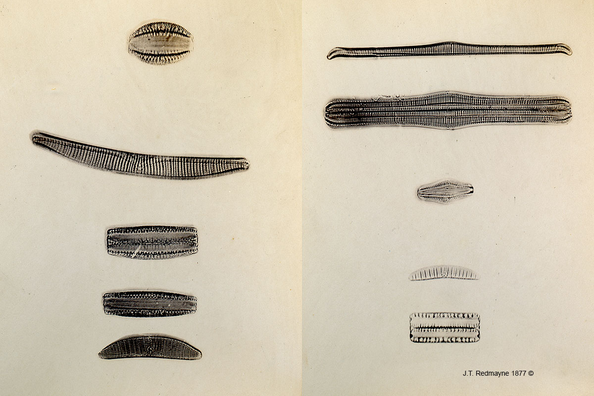 Diatoms by J.T. Redmayne 1877 Left: Plate 1 Magnification 500X 1. Epithemia turidia, 4. Epithemia granulata 5. Epithemia westermanni. 500X Right: Plate 3 - 1 Epithemia gibba, 3 Epithemia ventricosa 4. Epthemia zebra 500X.