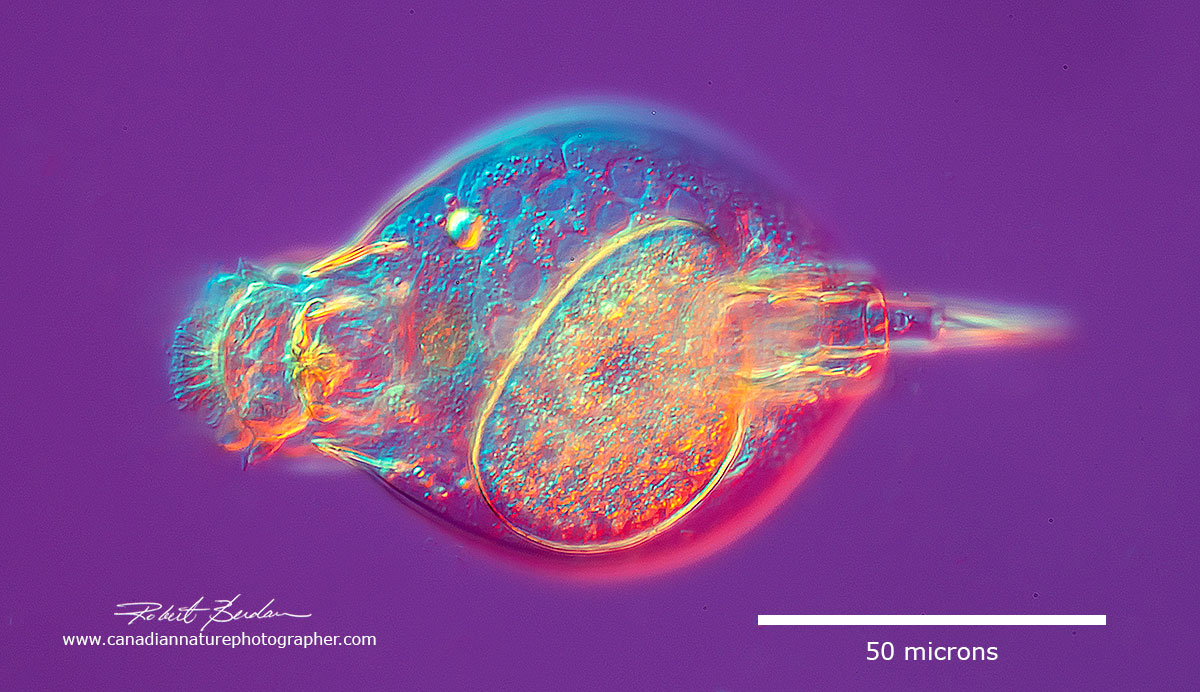 Lepadella ovalis with egg inside DIC microscopy