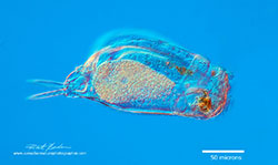 Euchlanis dilatata - a rotifer common in pond water  by Robert Berdan ©